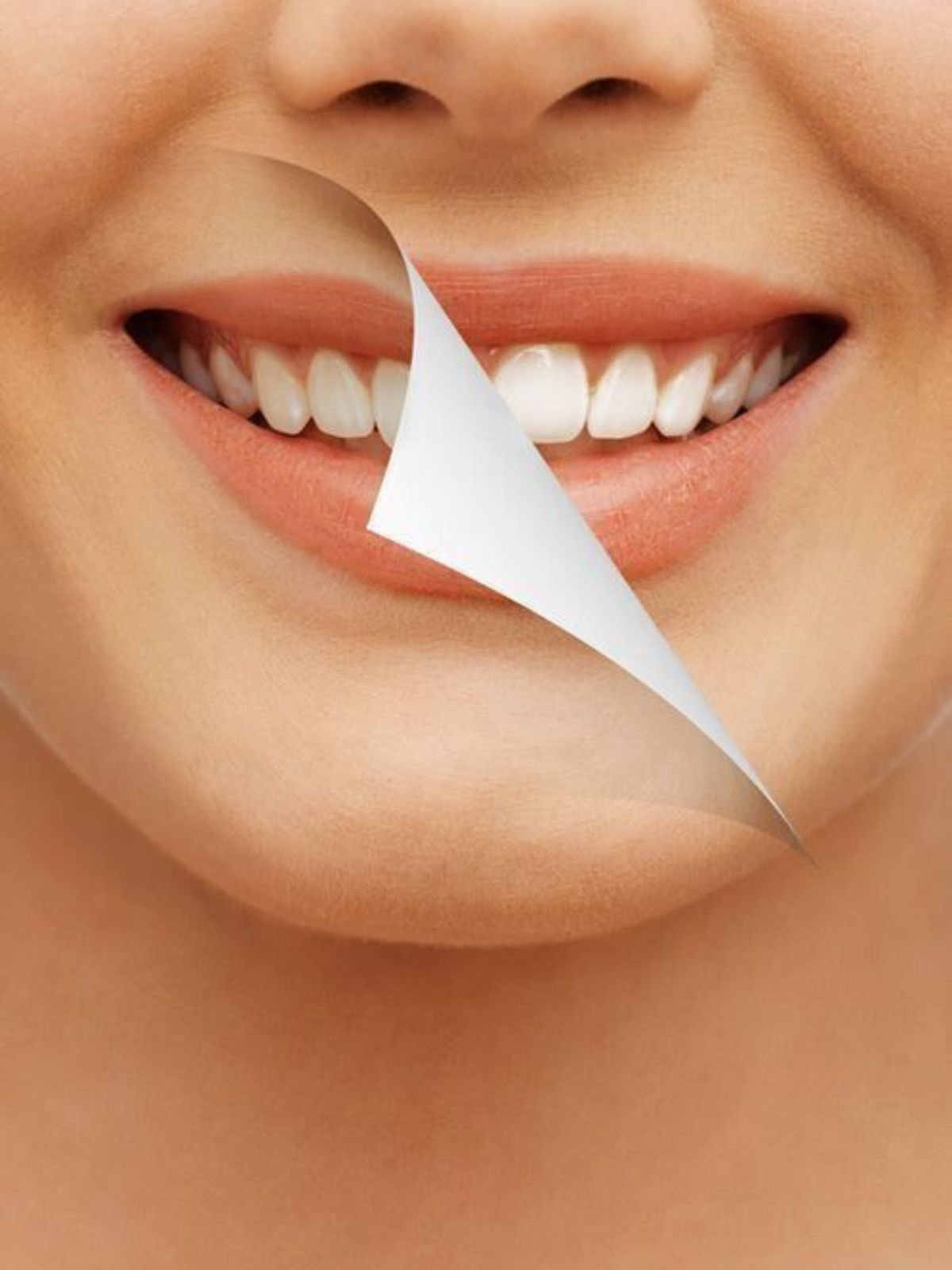 Soins dentaires